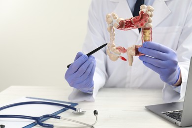 Photo of Doctor showing model of large intestine at white wooden table, closeup
