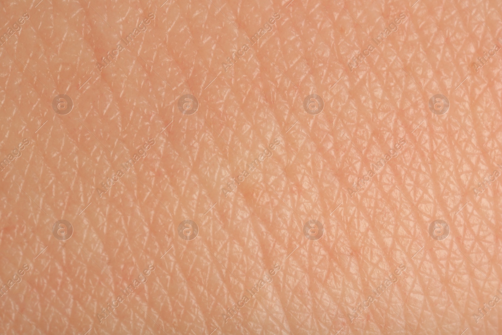 Photo of Texture of healthy skin as background, macro view