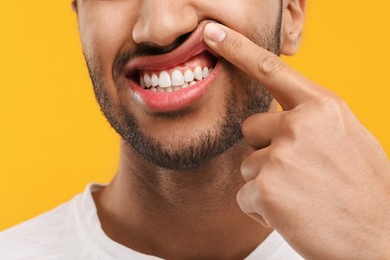 Photo of Man showing his healthy teeth and gums on orange background, closeup