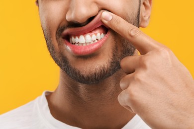 Man showing his healthy teeth and gums on orange background, closeup