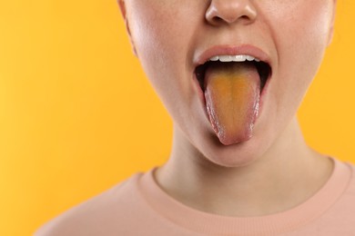 Gastrointestinal diseases. Woman showing her yellow tongue on color background, closeup