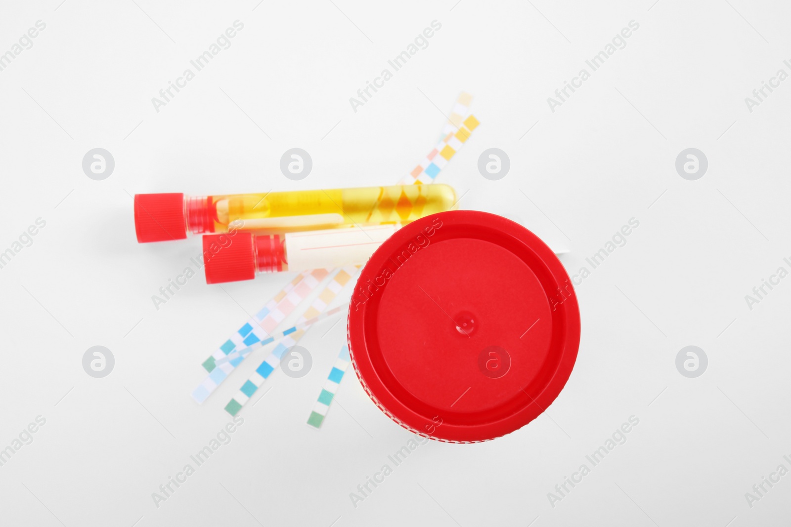 Photo of Laboratory ware with urine samples for analysis on white background, top view