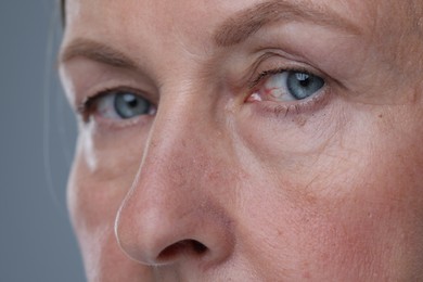 Senior woman with aging skin on grey background, closeup. Rejuvenation treatment