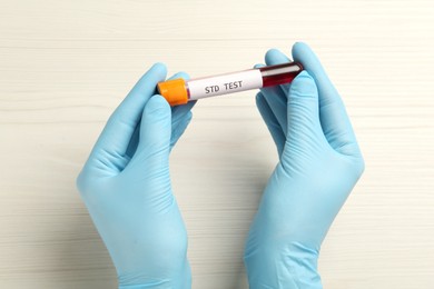 Photo of Scientist holding tube with blood sample and label STD Test at white table, top view