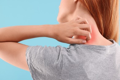 Suffering from allergy. Young woman scratching her neck on light blue background, closeup