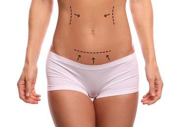 Image of Woman with markings for cosmetic surgery on her abdomen against white background, closeup