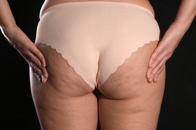 Photo of Woman with cellulite on black background, closeup