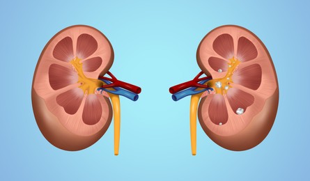 Illustration of  human kidney stones on blue background. Banner design