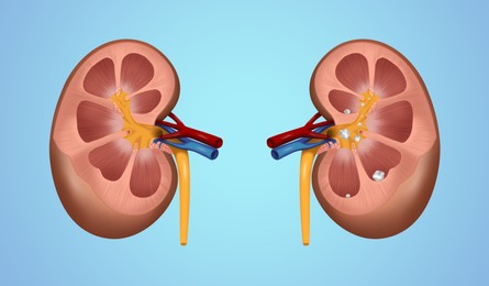 Illustration of human kidney stones on blue background. Banner design