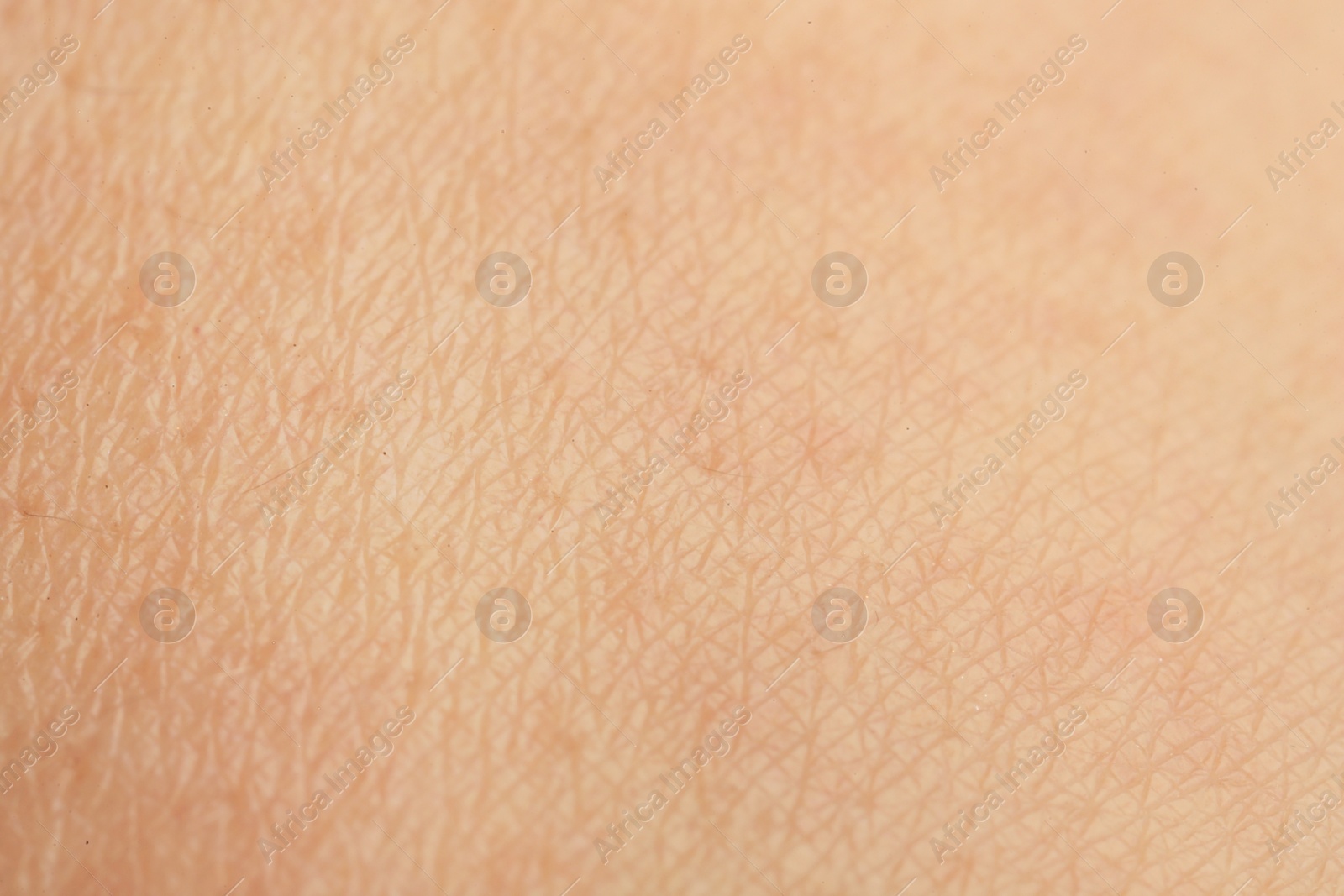 Photo of Texture of dry skin as background, macro view