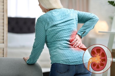 Image of Mature woman suffering from pain because of kidney stones disease at home