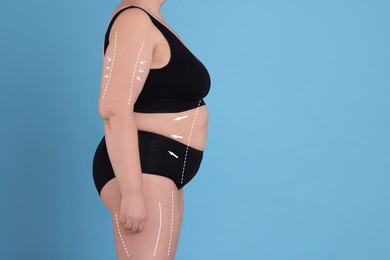 Woman with marks on body before cosmetic surgery operation on light blue background, closeup