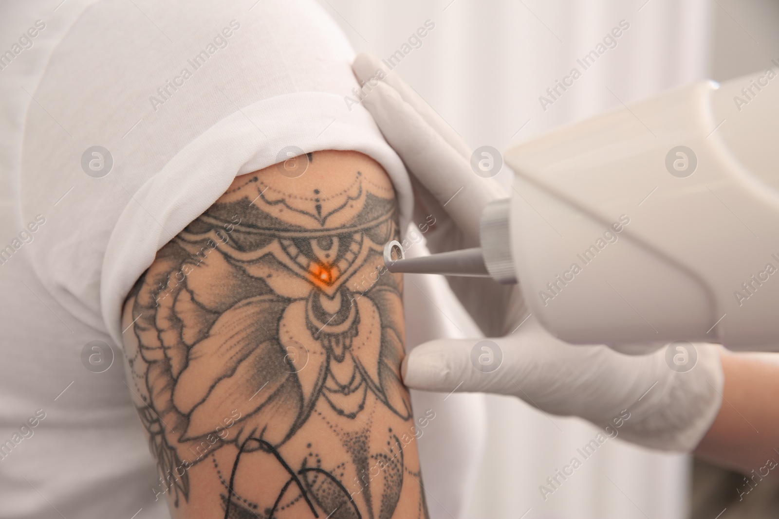 Photo of Young woman undergoing laser tattoo removal procedure in salon, closeup