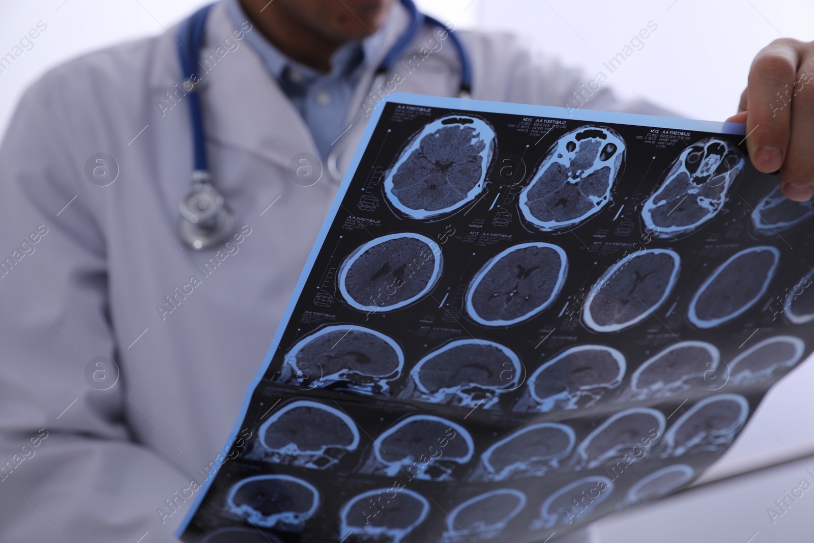 Photo of Doctor examining MRI images of patient with multiple sclerosis in clinic, closeup