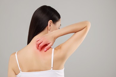 Photo of Suffering from allergy. Young woman scratching her skin on light grey background, back view