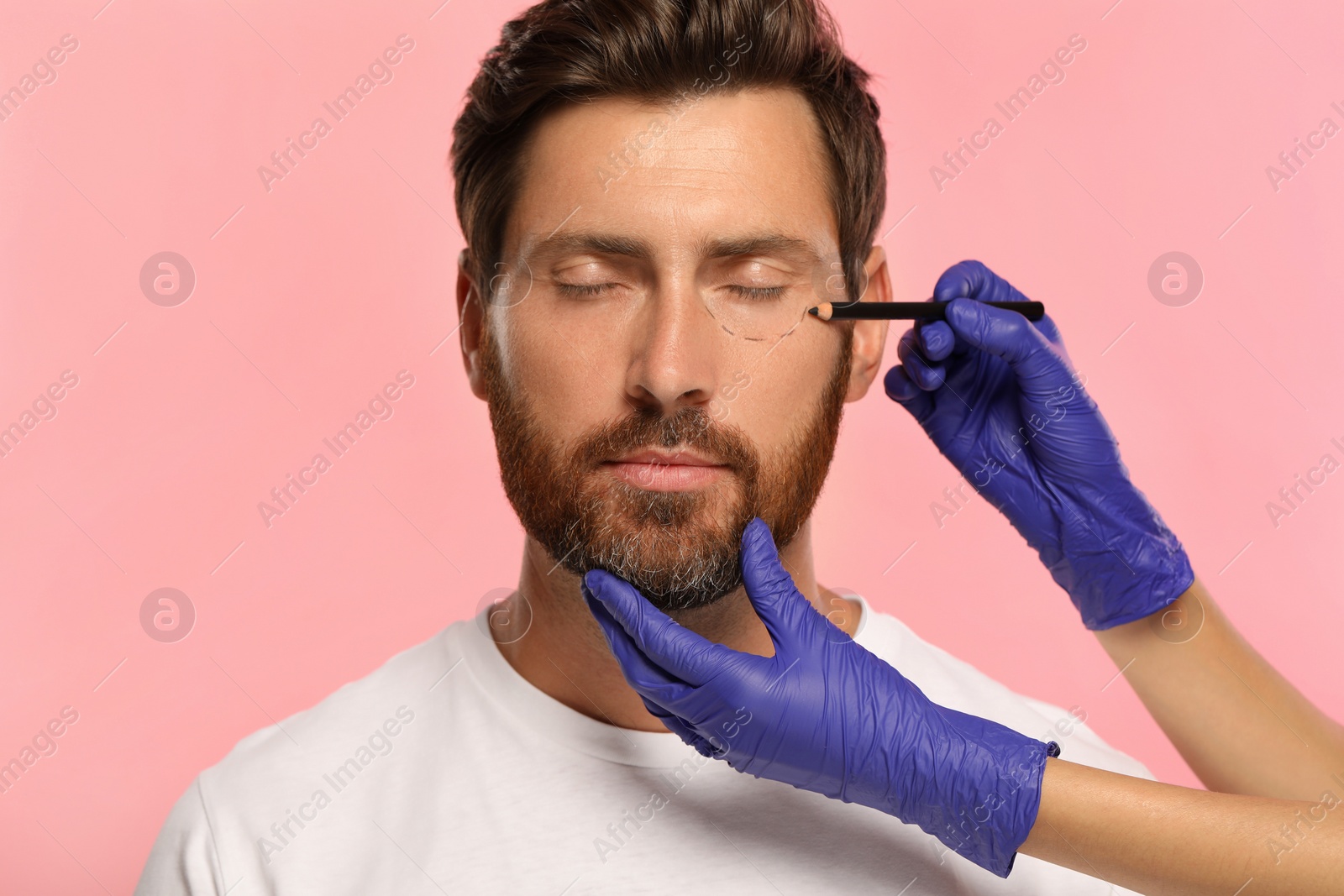 Photo of Doctor with pencil preparing patient for cosmetic surgery operation on pink background, closeup