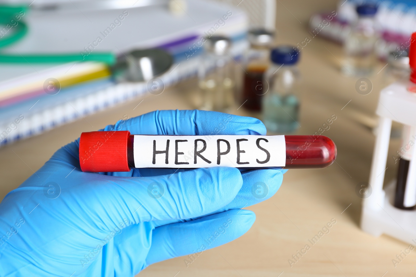 Photo of Doctor in glove holding test tube with word Herpes at wooden table, closeup