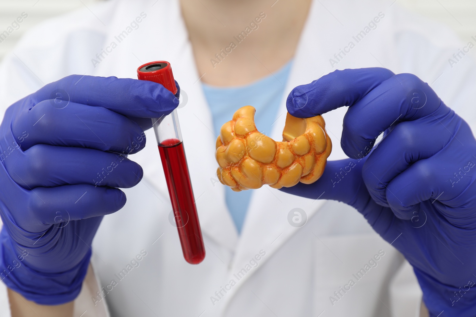 Photo of Endocrinologist showing thyroid gland model and blood sample in test tube, closeup