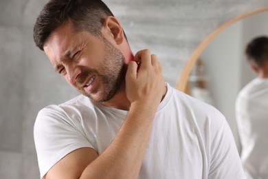 Photo of Man suffering from allergy scratching his neck indoors