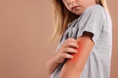 Photo of Suffering from allergy. Little girl scratching her arm on light brown background, closeup. Space for text