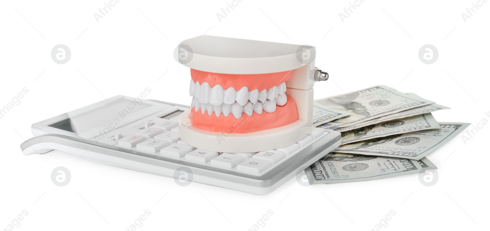 Photo of Educational dental typodont model, calculator and dollar banknotes on white background. Expensive treatment