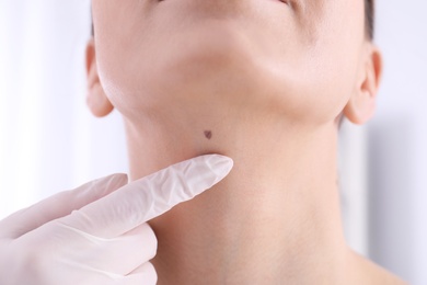 Photo of Dermatologist examining patient in clinic, closeup view