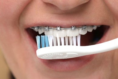 Photo of Woman with dental braces cleaning teeth, closeup