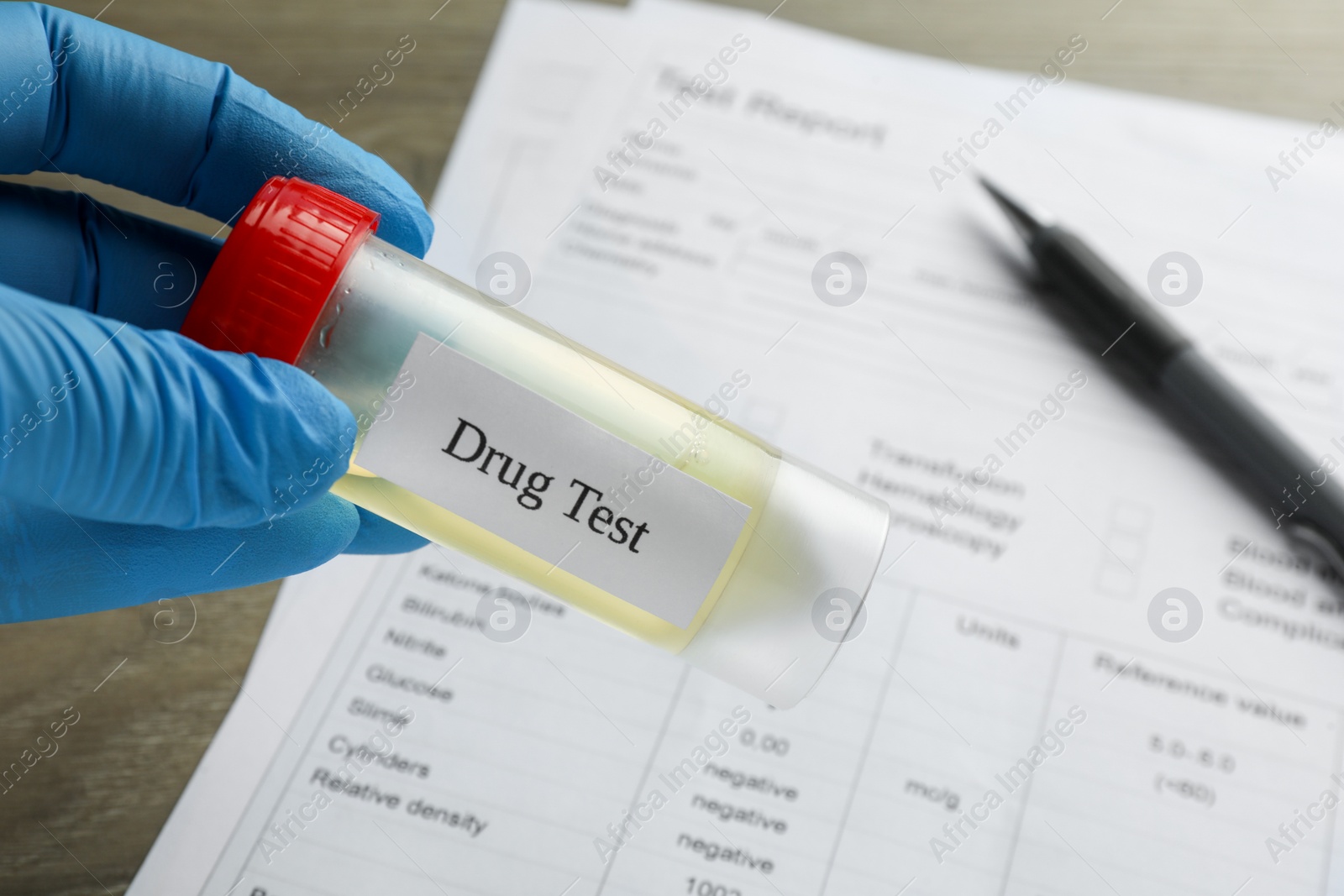 Photo of Drug test. Laboratory worker holding container with urine sample at table, closeup