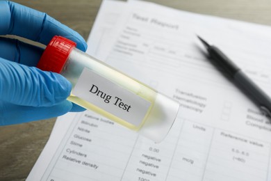 Photo of Drug test. Laboratory worker holding container with urine sample at table, closeup