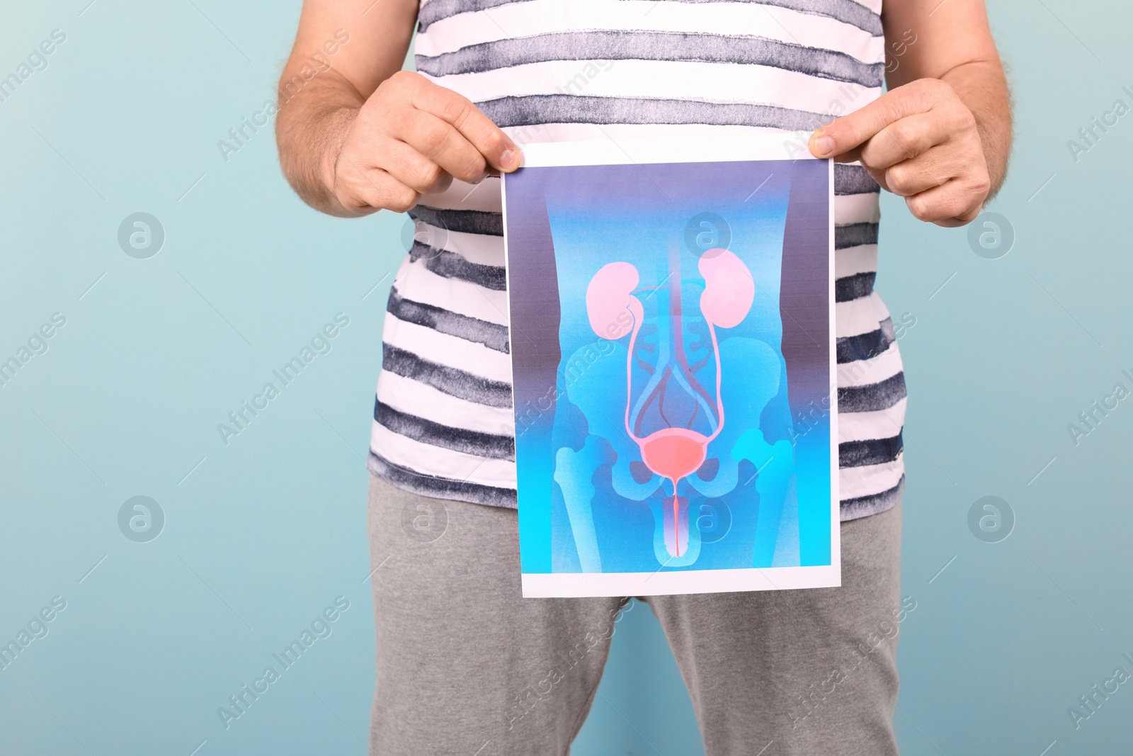 Photo of Mature man holding picture of urinary system on color background