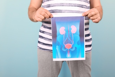 Photo of Mature man holding picture of urinary system on color background