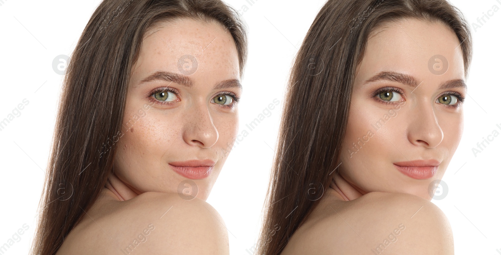 Image of Photo before and after retouch, collage. Portrait of beautiful young woman on white background, banner design