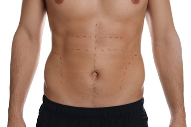 Photo of Fit man with marks on body against white background, closeup. Weight loss surgery