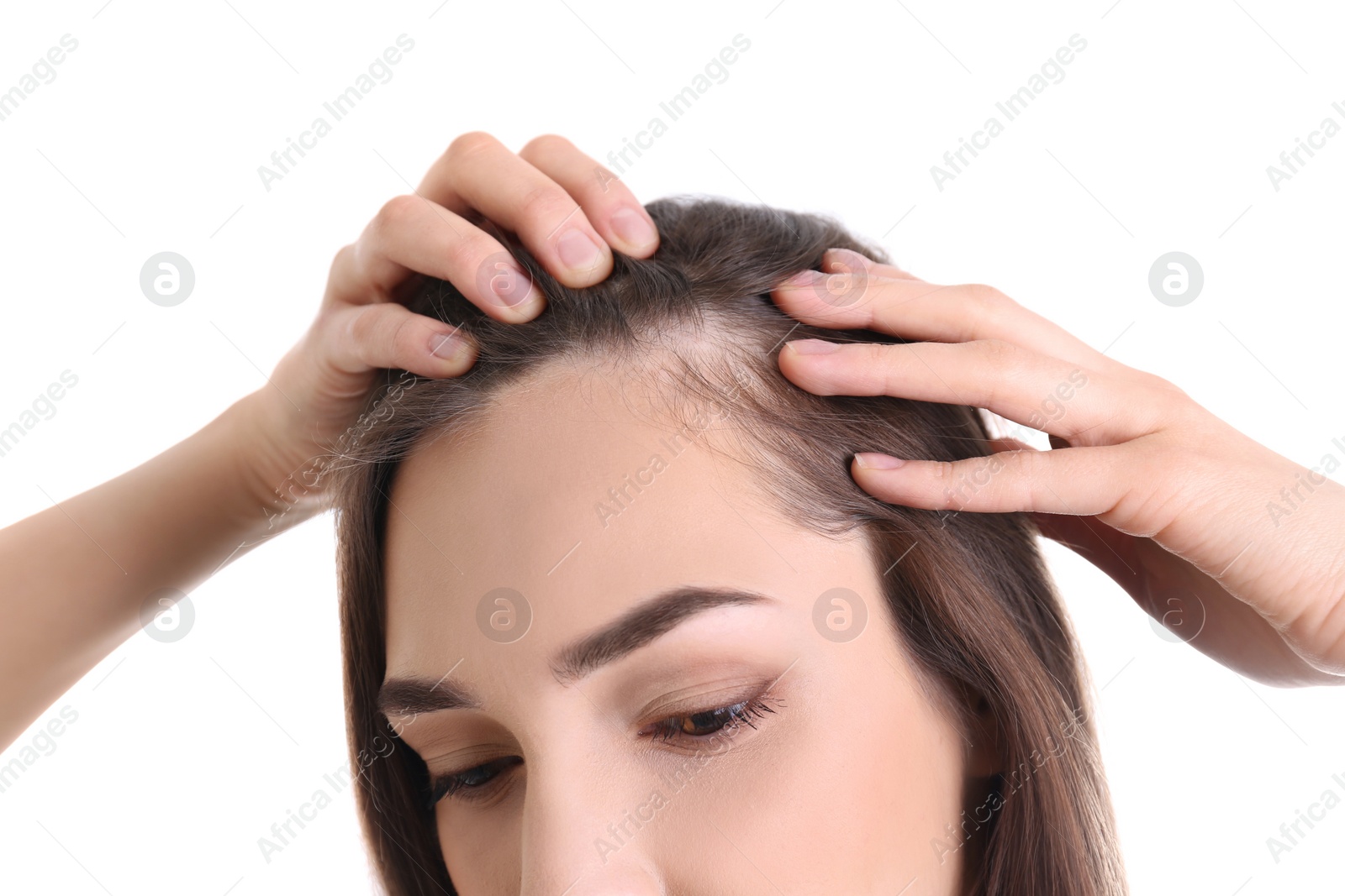 Photo of Young woman with hair loss problem on white background, closeup