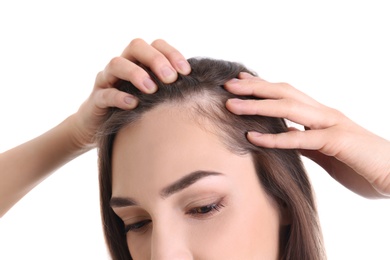 Young woman with hair loss problem on white background, closeup