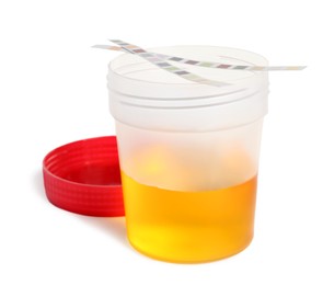 Container with urine sample for analysis and test strips on white background
