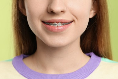 Smiling woman with dental braces on light green background, closeup
