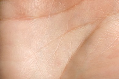 Closeup view of human hand with dry skin