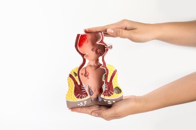 Photo of Proctologist holding anatomical model of rectum with hemorrhoids isolated on white, closeup
