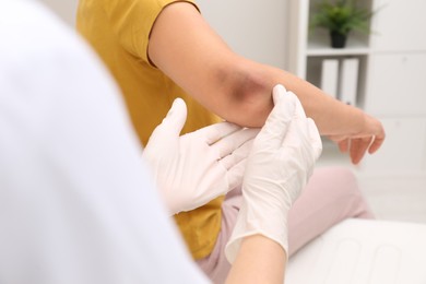 Photo of Doctor examining woman with bruise on elbow in clinic, closeup