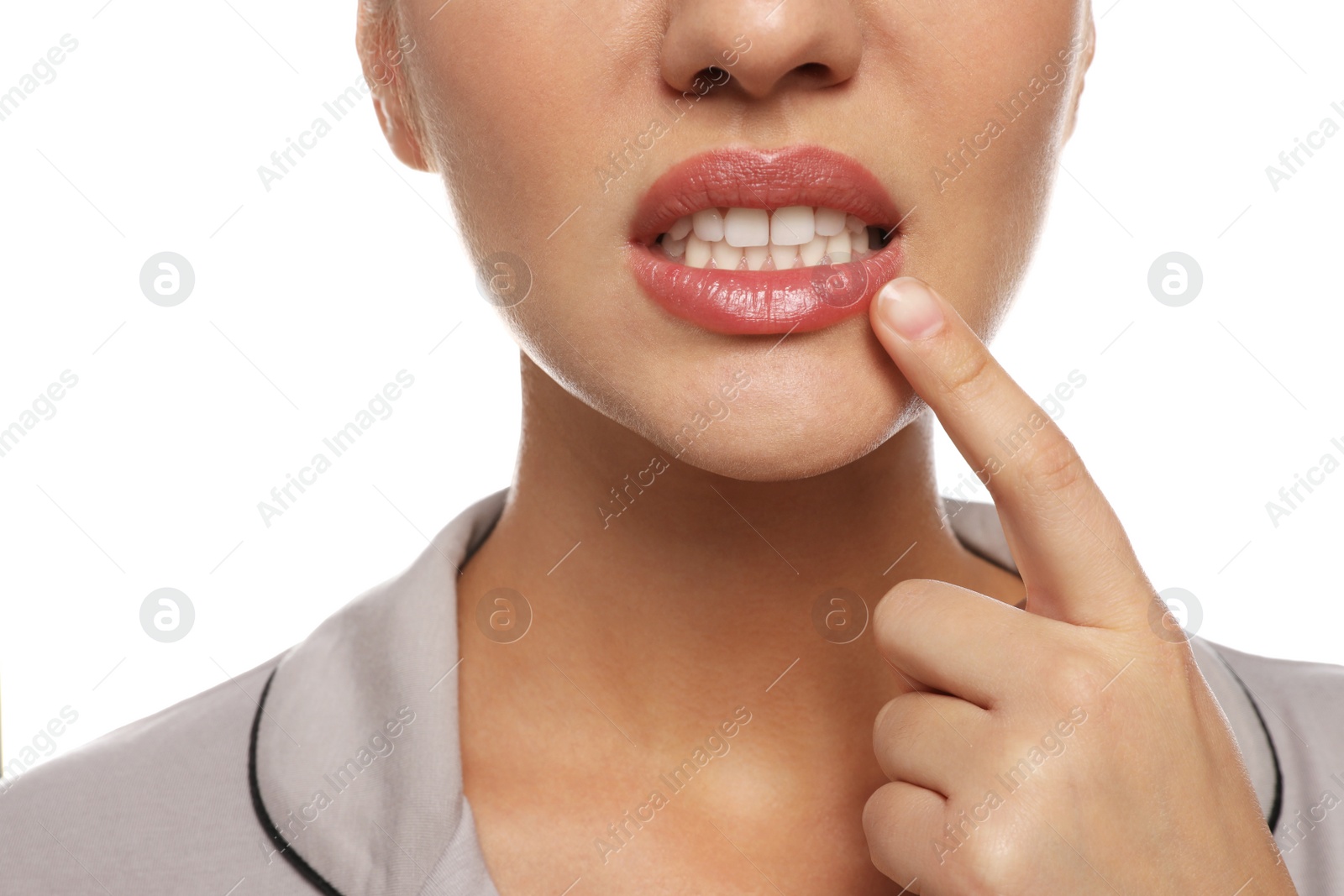 Photo of Woman with herpes touching lips on white background, closeup