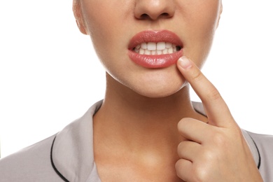 Woman with herpes touching lips on white background, closeup