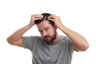 Photo of Man with dandruff in his dark hair on white background