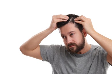 Photo of Man with dandruff in his dark hair on white background