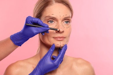 Photo of Doctor with pencil preparing patient for cosmetic surgery operation on pink background, closeup