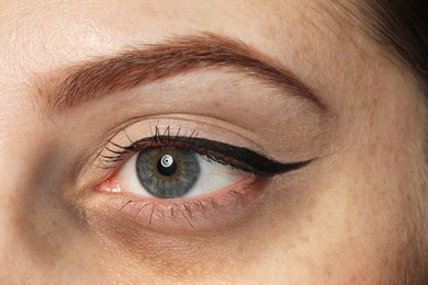 Tired young woman with dark circle under eye, closeup