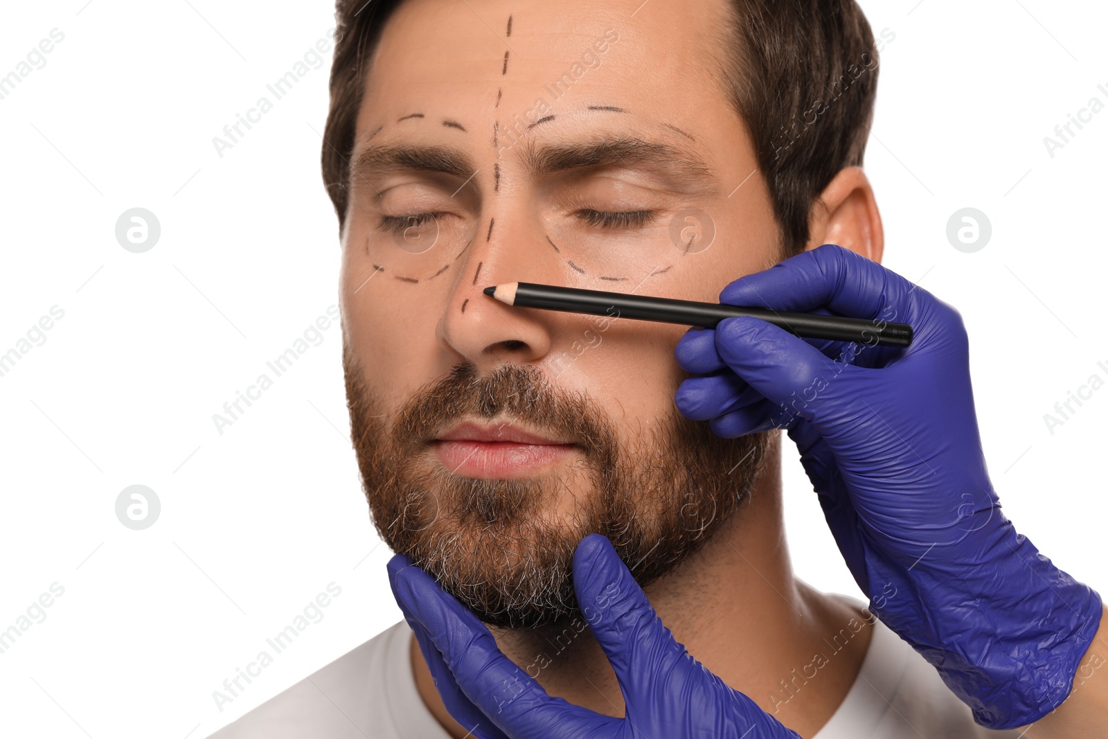 Photo of Doctor with pencil preparing patient for cosmetic surgery operation on white background, closeup