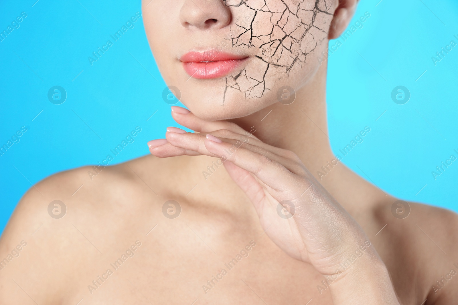 Image of Beautiful young woman with dry skin on light blue background, closeup