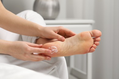 Photo of Young woman with dry skin applying cream onto her foot indoors, closeup