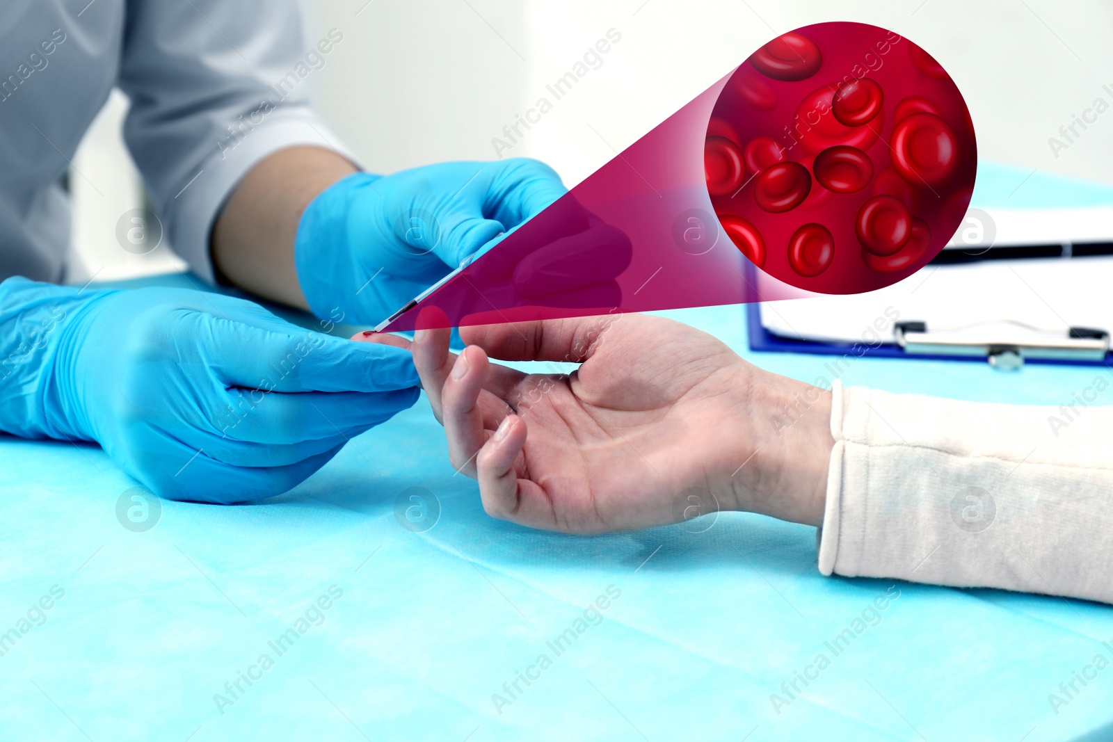 Image of Doctor taking blood sample from patient's finger at table in clinic, closeup